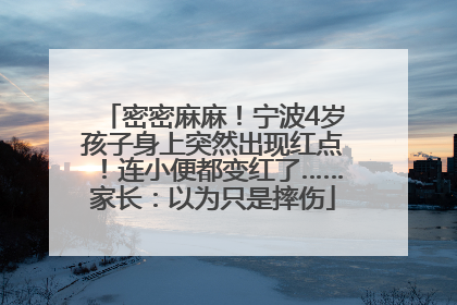密密麻麻！宁波4岁孩子身上突然出现红点！连小便都变红了……家长：以为只是摔伤